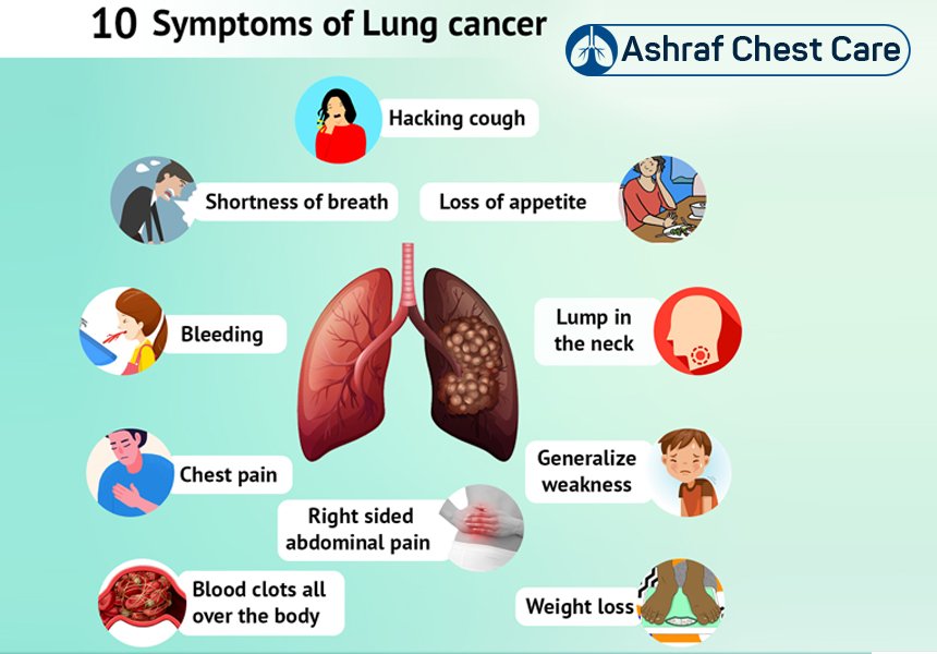 Ashraf Chest Care Hospital
